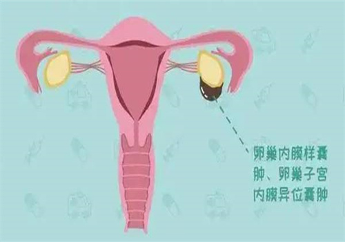 北京供卵：﻿精子畸形率很难改善吗？常用的治疗方法有这几种