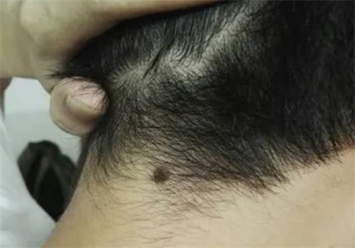 北京代怀生男孩价格：﻿胃炎有哪些症状表现,胃炎怎么调理才能痊愈
